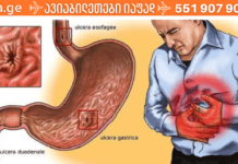 მომატებული მჟავიანობით მიმდინარე გასტრიტის დროს რეკომენდებულია შემდეგი საშუალებების მიღება: