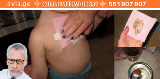 მე ვიცი რამდენიმე რეცეპტი, რომელიც უებარია ბრონქიტის დროს: ჩემი შვილები ყოველჯერზე ამით მოვარჩინე!