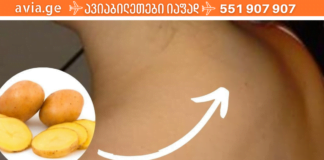 თუ კისერზე მარილები დაგიგროვდათ, კარტოფილის კომპრესები მოგიხსნით გაუსაძლის ტკივილებს!