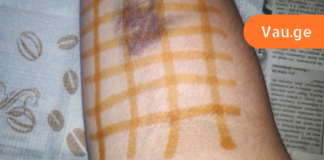 ბიბლიაში დაწერილი წამალი!! ეს ძლიერი და 2000 წლის წინანდელი საშუალება კურნავს ყველა დაავადებას!!