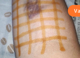 ბიბლიაში დაწერილი წამალი!! ეს ძლიერი და 2000 წლის წინანდელი საშუალება კურნავს ყველა დაავადებას!!