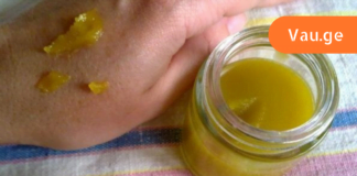 მე ვიპოვე მკურნალობის მეთოდი, რომელმაც მიშველა დამწვრობის პირველივე წუთებში! გირჩევთ თქვენც სცადოთ, არ ინანებთ!!!