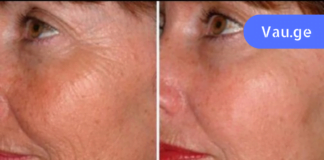 ჩემი სახის კანი ყველას აოცებს და როცა საკუთარ ასაკს ვამხელ ხოლმე, არავინ მიჯერებს. აი რას ვაკეთებ!