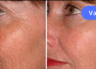 ჩემი სახის კანი ყველას აოცებს და როცა საკუთარ ასაკს ვამხელ ხოლმე, არავინ მიჯერებს. აი რას ვაკეთებ!