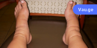 თესლი, რომელიც მოგიხსნით ფეხების შეშუპებას და აღადგენს მყესებს უმოკლეს დროში!