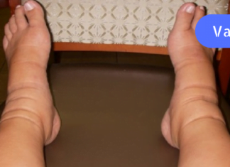 თესლი, რომელიც მოგიხსნით ფეხების შეშუპებას და აღადგენს მყესებს უმოკლეს დროში!