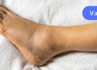 თუ ეს სიმპტომები გაწუხებთ დროულად მიხედეთ თქვენს თირკმელებს! ეს უნდა იცოდეთ!