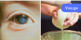 ყველაზე ძლიერი ბუნებრივი ანტიბიოტიკი, რომელის კლავს თვალის ინფექციას! ის ძალიან სწრაფად მოგცემთ შედეგს!