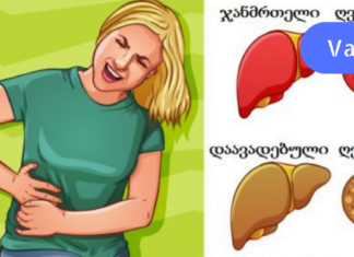 14 სიმპტომი, რაც ღვიძლის დაავადებაზე მიგითითებთ! ეს არ უნდა დააიგნოროთ!