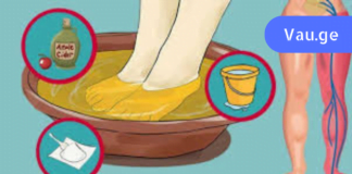 რეცეფტი, რომელიც უებარი აღმოჩნდა საჯდომის ნერვის ანთების სამკურნალოდ! მერწმუნეთ, შედეგებით გაოცდებით!