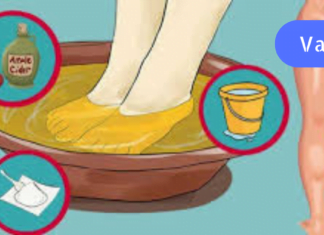 რეცეფტი, რომელიც უებარი აღმოჩნდა საჯდომის ნერვის ანთების სამკურნალოდ! მერწმუნეთ, შედეგებით გაოცდებით!