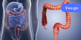 გაიწმინდეთ ნაწლავები სახლის პირობებში ამ ნატურალური რეცეპტების დახმარებით. ეს ყველას ორგანიზმს სჭირდება