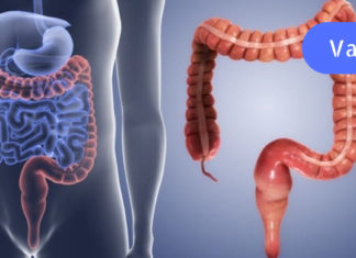 გაიწმინდეთ ნაწლავები სახლის პირობებში ამ ნატურალური რეცეპტების დახმარებით. ეს ყველას ორგანიზმს სჭირდება