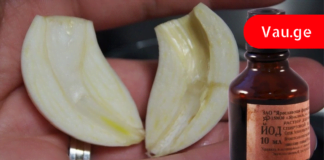 ნიორი და იოდი: სასწაულმოქმედი რეცეპტი პირდაპირ მოხუცი ექთნის ბლოკნოტიდან.