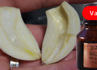 ნიორი და იოდი: სასწაულმოქმედი რეცეპტი პირდაპირ მოხუცი ექთნის ბლოკნოტიდან.