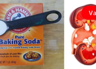 აი, რა მოუვა თქვენს თირკმელებს თუ ნახევარ კოვზ საკვებ სოდას მიიღებთ…