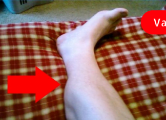 იცით რა იწვევს კუნთების კრუნჩხვებს? ამის ცოდნა მნიშვნელოვანია!!!