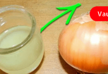 საშარდე გზებში კენჭების დაშლის უებარი საშუალება – ნეტავ აქამდე მცოდნოდა!