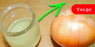 საშარდე გზებში კენჭების დაშლის უებარი საშუალება – ნეტავ აქამდე მცოდნოდა!