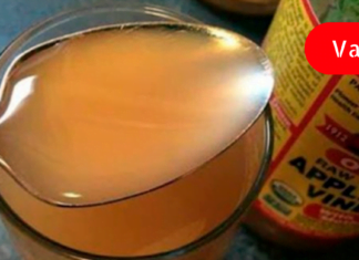 ვაშლის ძმრის 1 კოვზის მიღებას 40 დღის განმავლობაში შეუძლია დაეხმაროს აქ ჩამოთვლილ ჯანმრთელობის პრობლემებს.