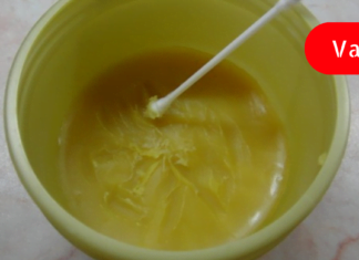 ჯადოსნური მალამო, რომელიც  ვარიკოზული ვენების მშველელია ყველაზე რთულ ეტაპზეც კი !