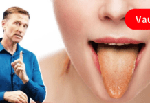 Შეხედეთ თქვენი ენის ფერს და გაიგებთ რომელი დაავადება გაწუხებთ!