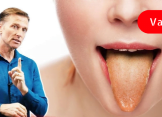 Შეხედეთ თქვენი ენის ფერს და გაიგებთ რომელი დაავადება გაწუხებთ!