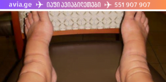 თესლი, რომელიც მოგიხსნით ფეხების შეშუპებას და აღადგენს მყესებს უმოკლეს დროში!