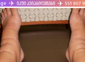 თესლი, რომელიც მოგიხსნით ფეხების შეშუპებას და აღადგენს მყესებს უმოკლეს დროში!