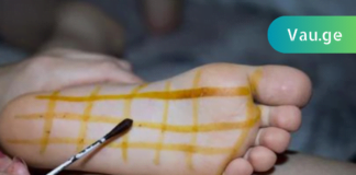 50 წლის ასაკში დავამარცხე ფეხების აუტანელი ოფლიანობა! სცადე და არ ინანებ!