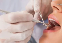 ღიმილი, როგორც ხელოვნება: თანამედროვე სტომატოლოგიის მიღწევები A professional dentist performing a dental examination on a patient using specialized tools.